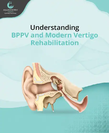 BPPV and Modern Vertigo Rehabilitation