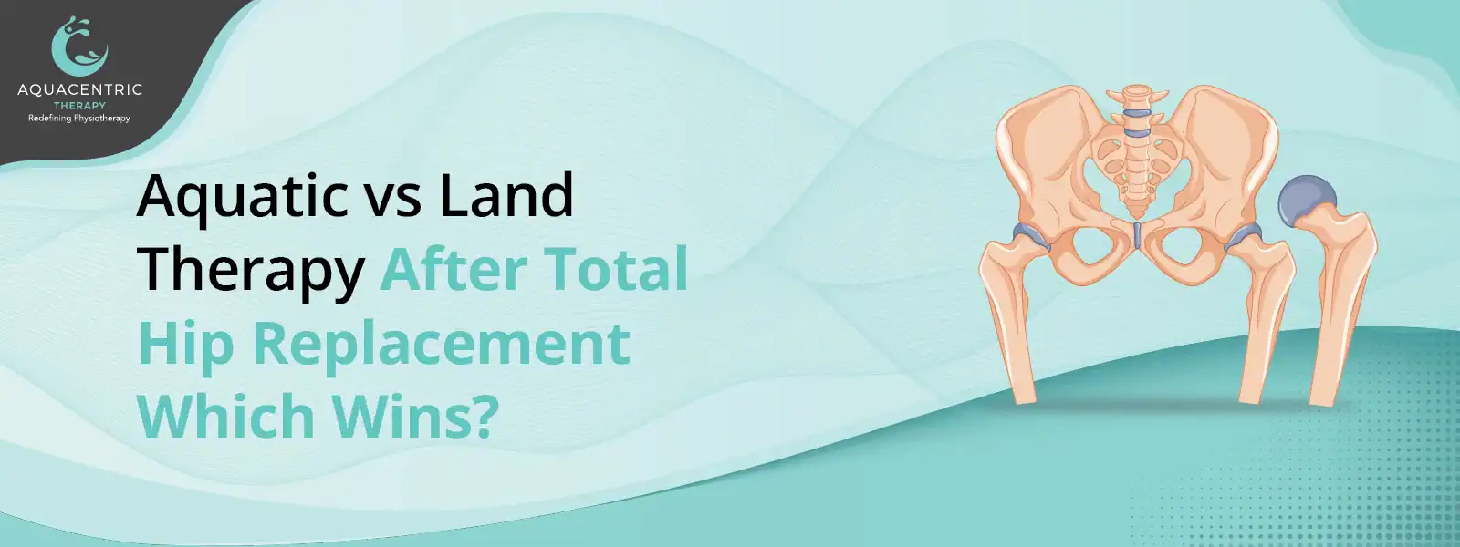 Aquatic vs Land Therapy After Total Hip Replacement | Which Wins? 1 Aquatic vs land therapy comparison after hip replacement surgery