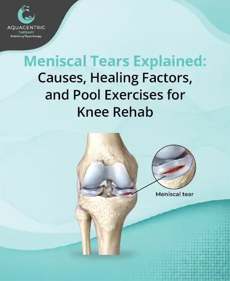 Meniscal Tears Explained: Causes, Healing Factors, and Pool Exercises for Knee Rehab